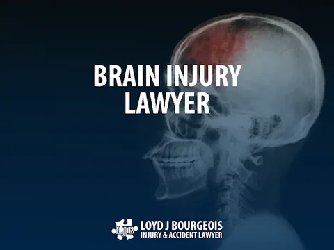 Loyd J Bourgeois Injury & Accident Lawyer